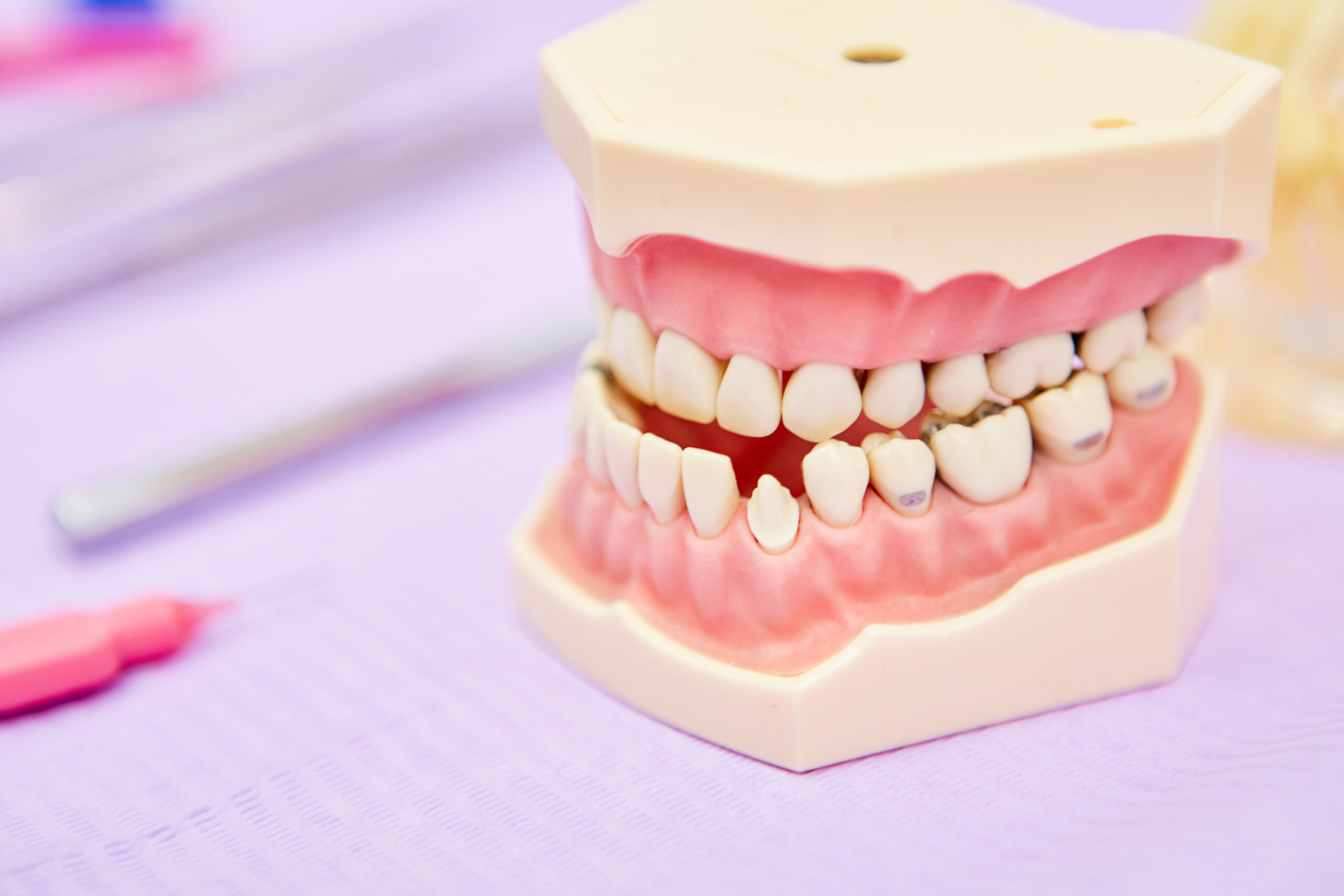 Denti e postura: quale correlazione?