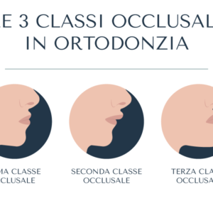 classi occlusali ortodonzia