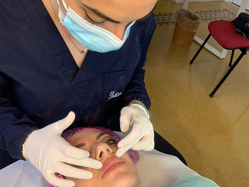 Filler labbra: la medicina estetica al servizio del tuo sorriso