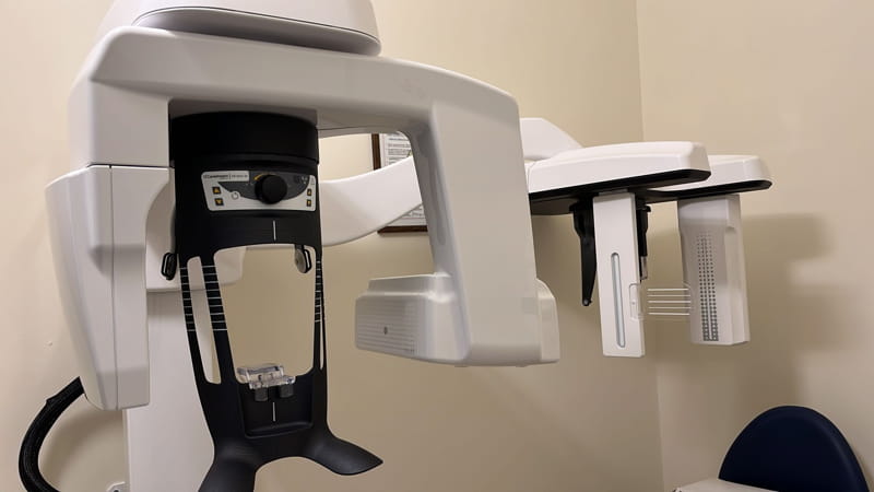 TAC dentale 3D: a cosa serve e quali vantaggi