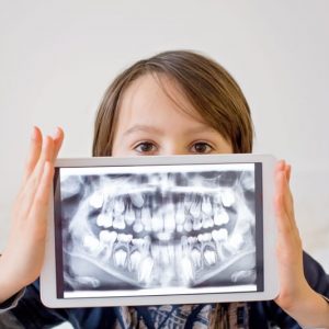 radiografie odontoiatriche bambini