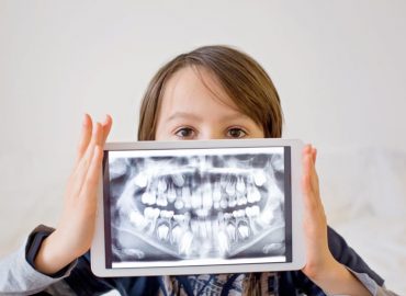 Radiografie odontoiatriche nei bambini: ci sono rischi?