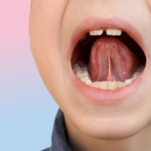 salute orale e logopedia