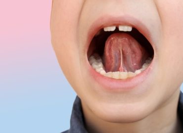 Quale correlazione tra salute orale e logopedia?