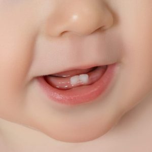dentizione nei bambini
