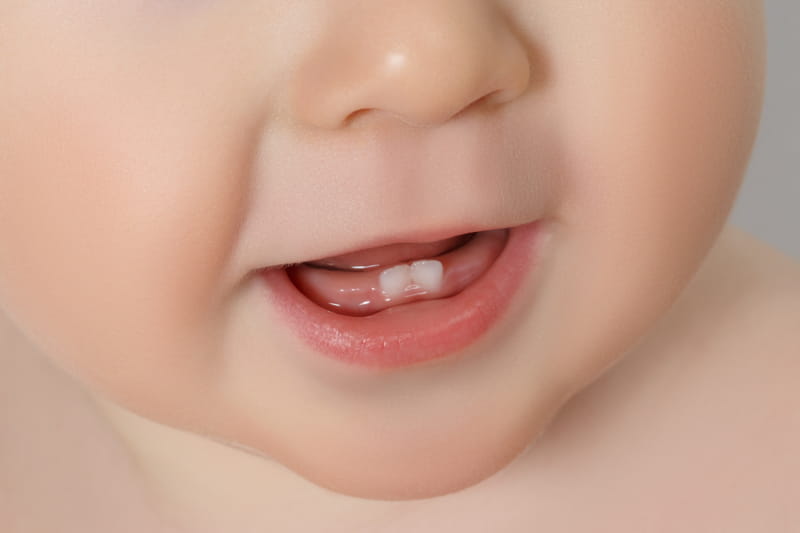 Dentizione nei bambini: quando inizia e come alleviare il dolore